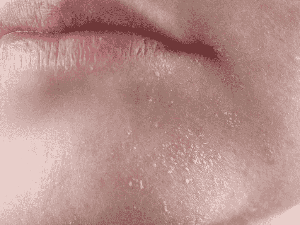 Dehidratavusi oda - DayGlow